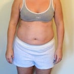 1 Front View Sami Cone Weight Loss 150x150 Let the Life Transformation Begin! Weight Loss Day 1